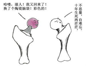 人工关节寿命有多长.jpg 人工关节寿命有多长.jpg