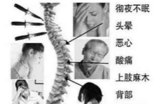 治疗颈椎病的方法.jpg 治疗颈椎病的方法.jpg