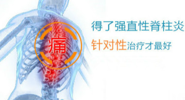 强直性脊柱炎治疗1.jpg 强直性脊柱炎治疗1.jpg