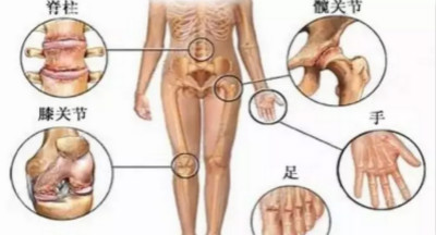 关节疼痛.jpg 关节疼痛.jpg