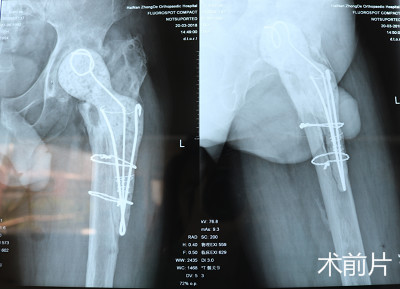 QQ截图20180404083840.png QQ截图20180404083840.png
