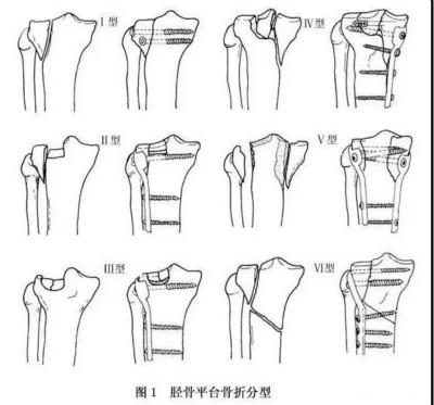 u=3874507696,3985725010&fm=26&gp=0.jpg u=3874507696,3985725010&fm=26&gp=0.jpg