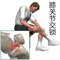 半月板损伤治疗.jpg 半月板损伤治疗.jpg