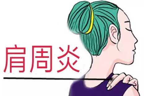 常见的肩周炎病因.jpg 常见的肩周炎病因.jpg