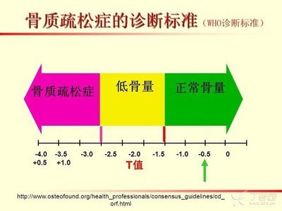 骨质疏松诊断.jpg