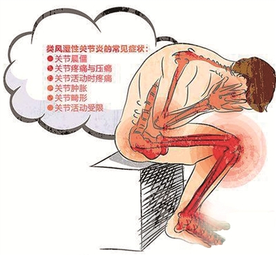 类风湿性疾病是什么原因造成的.jpg 类风湿性疾病是什么原因造成的.jpg