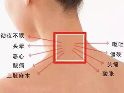 颈椎病的死穴是高血压.jpg 颈椎病的死穴是高血压.jpg