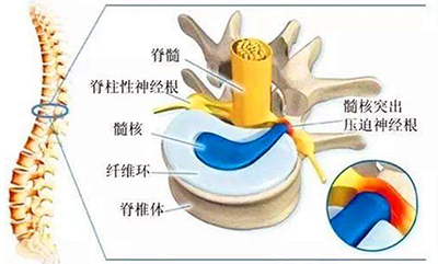腰椎2.jpg 腰椎2.jpg