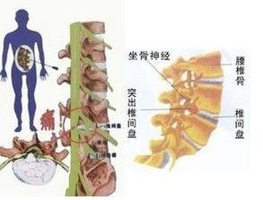 日常留下,远离骨质增生.jpg 日常留下,远离骨质增生.jpg