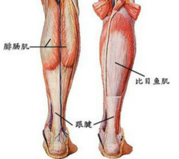 跟腱炎的临床表现.jpg 跟腱炎的临床表现.jpg