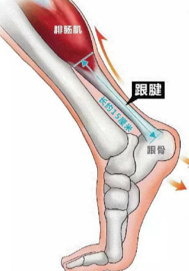 跟腱炎出现的症状.jpg 跟腱炎出现的症状.jpg
