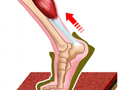 跟腱炎的自我保护.jpg 跟腱炎的自我保护.jpg