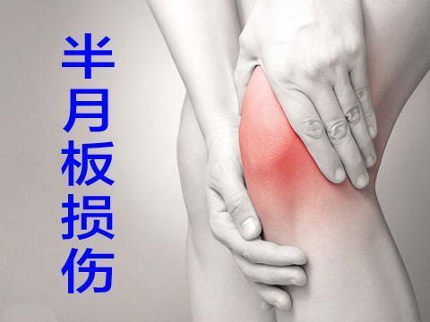 半月板损伤的治疗.jpg 半月板损伤的治疗.jpg