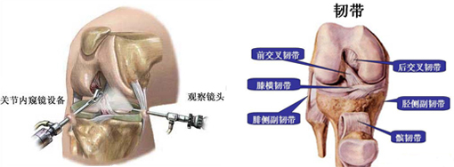 软组织损伤的病例机制.jpg 软组织损伤的病例机制.jpg
