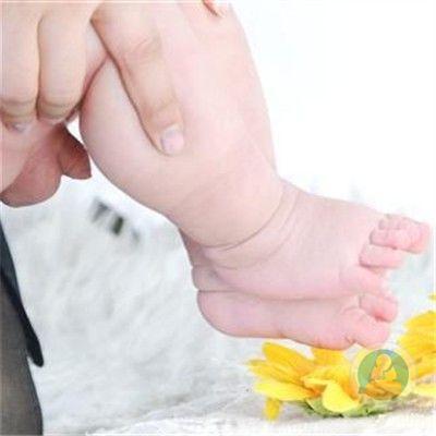 手足畸形7.jpg 手足畸形7.jpg