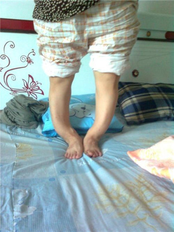 罗圈腿6.jpg 罗圈腿6.jpg