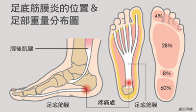 筋膜炎海南中德骨科医院.jpg 筋膜炎海南中德骨科医院.jpg