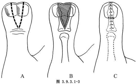 5a6fe56e0c82c.jpg 5a6fe56e0c82c.jpg