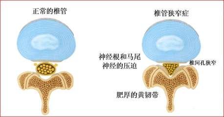 u=4181958418,214057411&fm=26&gp=0.jpg u=4181958418,214057411&fm=26&gp=0.jpg