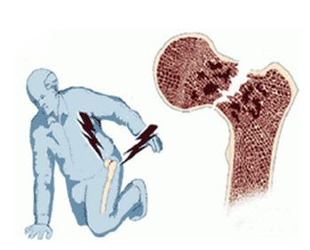 timg (1).jpg timg (1).jpg